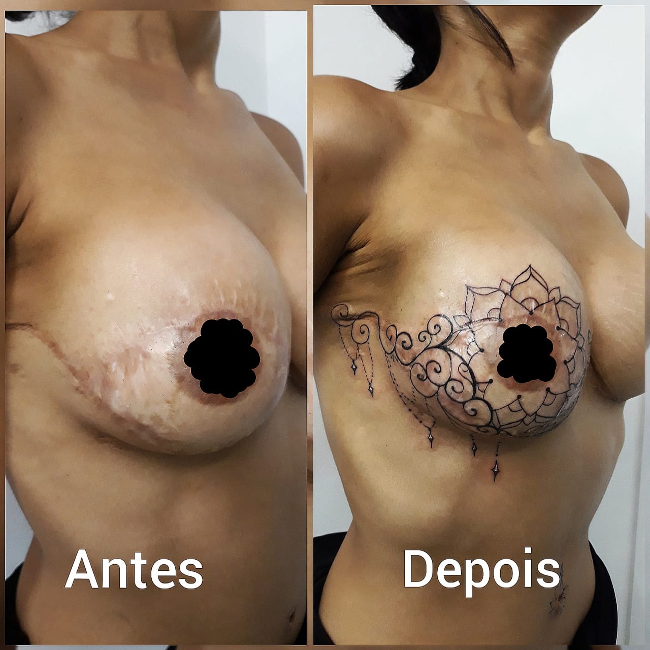 Cobertura de Cicatriz e Tatuagem - Tatuador Batel - Curitiba - Fernanda Mello Tattoo