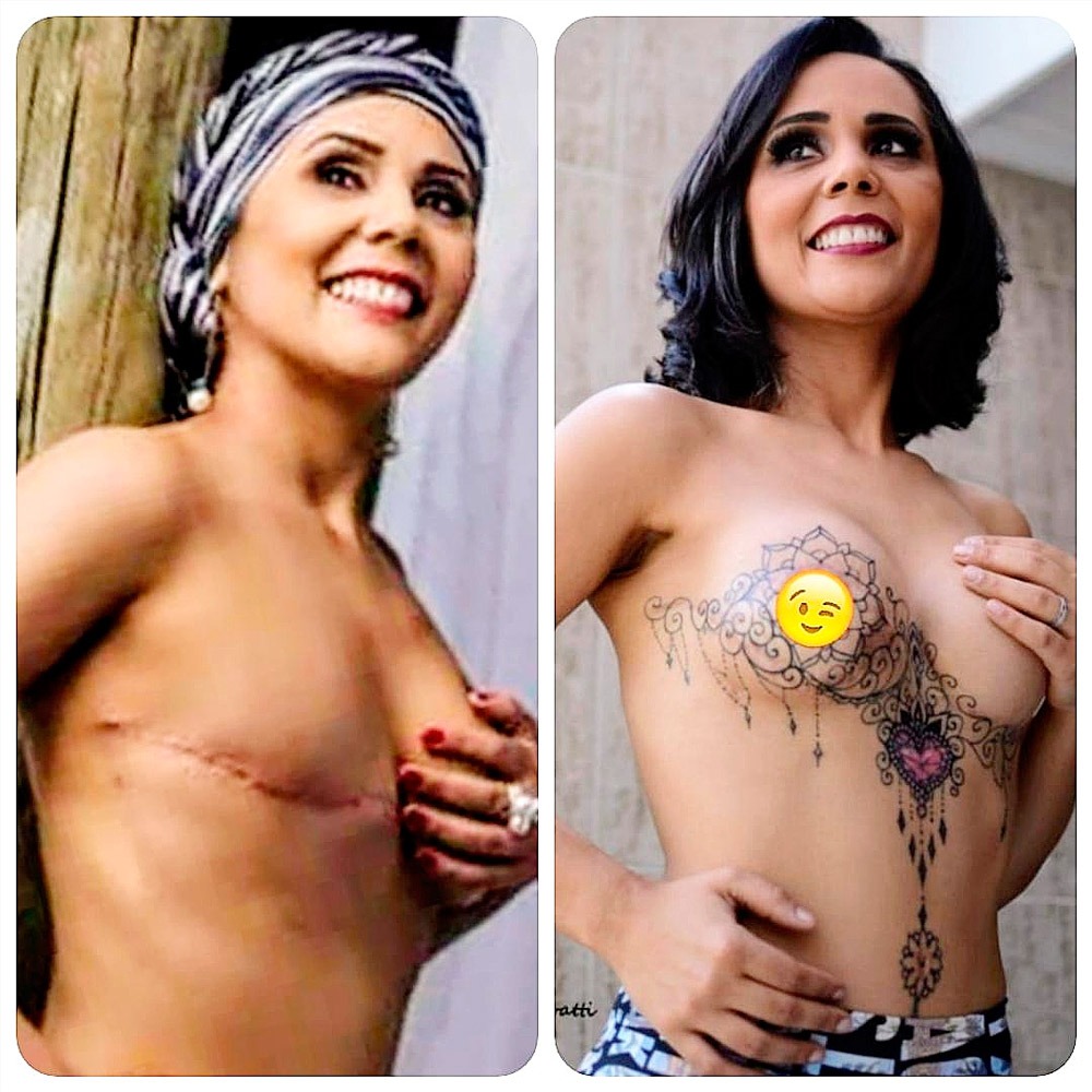 COMO A TATUAGEM EM CURITIBA AUMENTA A AUTOESTIMA DAS MULHERES APÓS A MASTECTOMIA