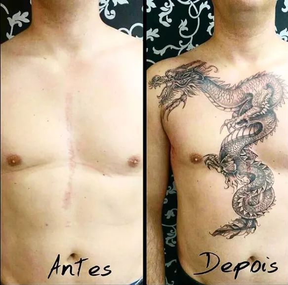 Você sabia que pode cobrir uma cicatriz que te incomoda com uma tatuagem?