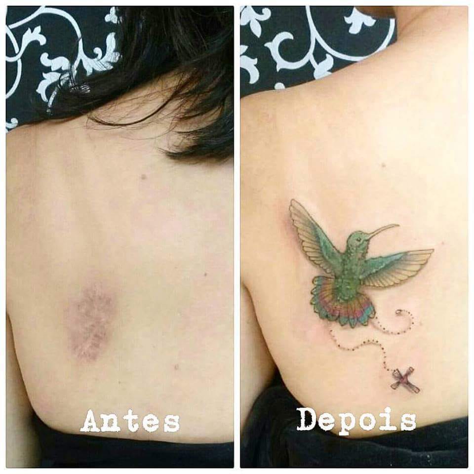 Você sabia que pode cobrir uma cicatriz que te incomoda com uma tatuagem?