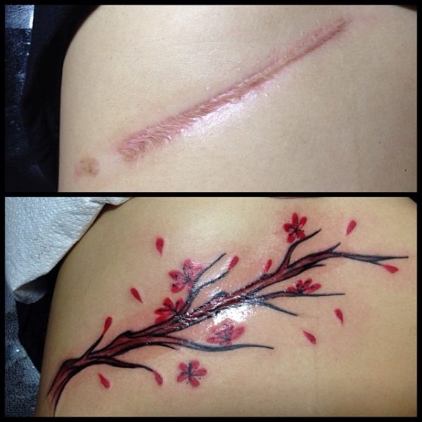 Tatuagens para esconder cicatrizes